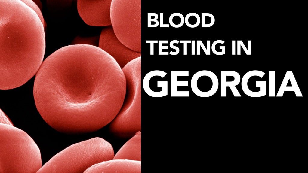 Blood Alcohol Test (BAC Test) DUI Laws