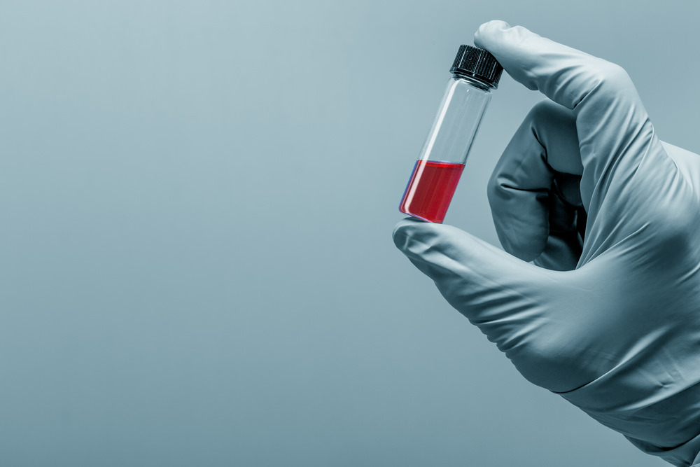 Blood Alcohol Test (BAC Test) DUI Laws